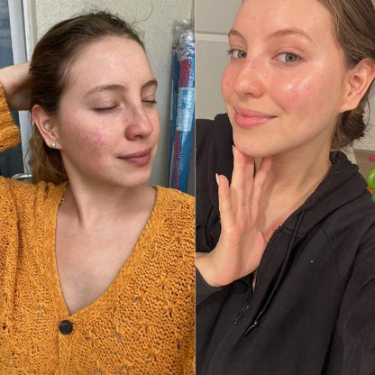 Collagen Face Cream Suit